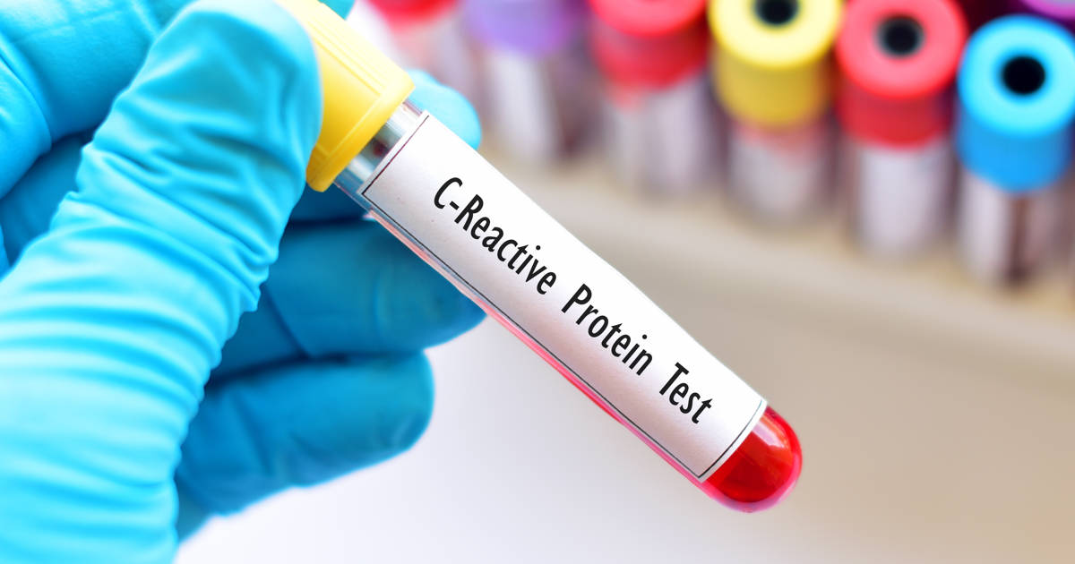 High C-Reactive Protein: Symptoms and Causes